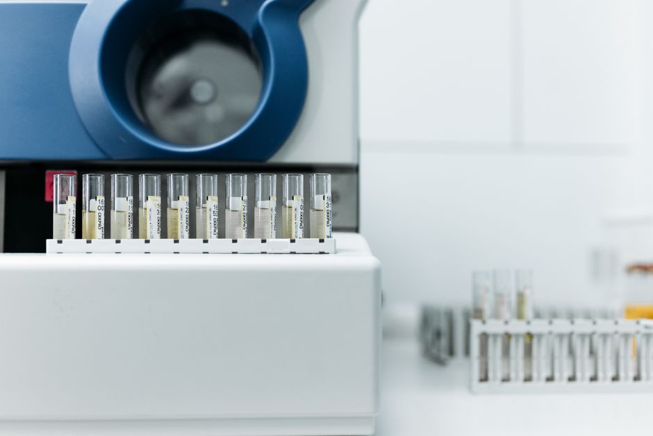 Lab technician handling a urine sample cup for a hydrocodone drug test